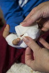 Foto: verletzter Finger eines Kindes wird verbunden
